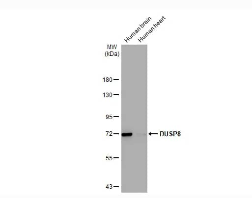 DUSP8 Antibody (HL2338)