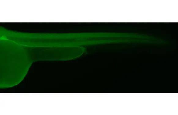 PELO Antibody (HL2345)