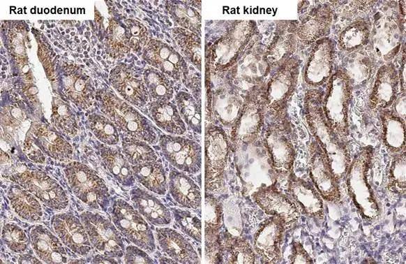 PELO Antibody (HL2345)