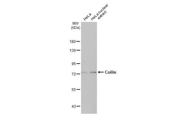 Coilin Antibody (HL2384)