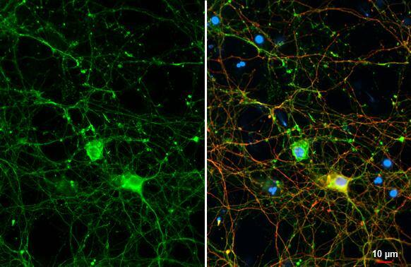 GPM6A Antibody (HL2473)
