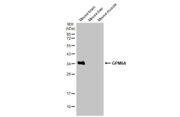 GPM6A Antibody (HL2473)