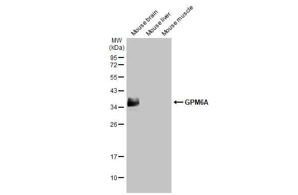 GPM6A Antibody (HL2474)