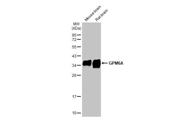 GPM6A Antibody (HL2474)