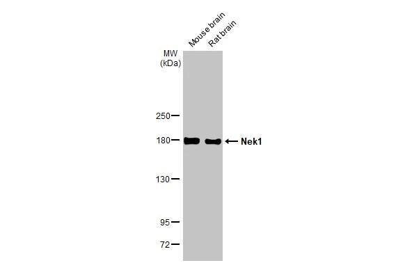 NEK1 Antibody (HL2489)