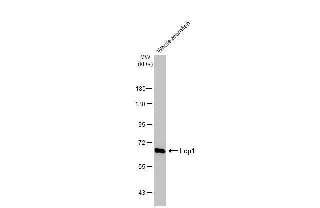 Plastin L Antibody (HL2501)