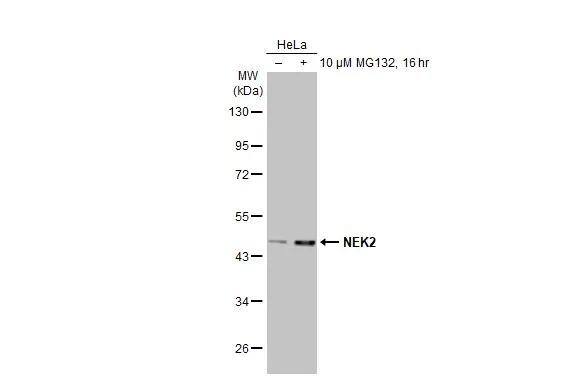 NEK2 Antibody (HL2511)