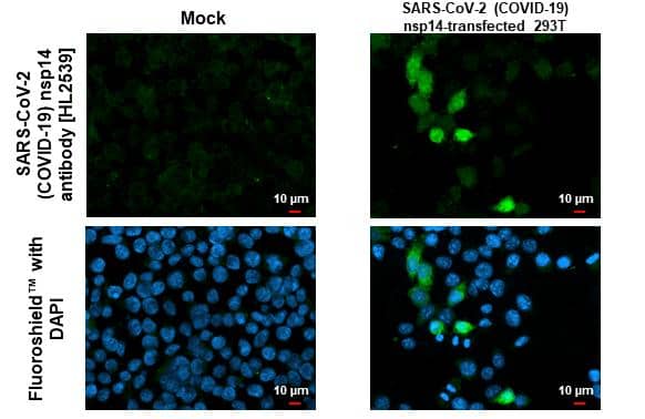 SARS-CoV-2 nsp14 Antibody (HL2539)