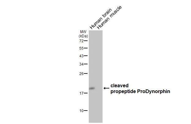 Prodynorphin/PDYN Antibody (HL2573)