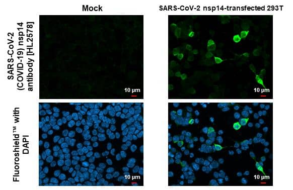SARS-CoV-2 nsp14 Antibody (HL2578)