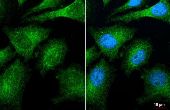 CNOT8 Antibody (HL2586)