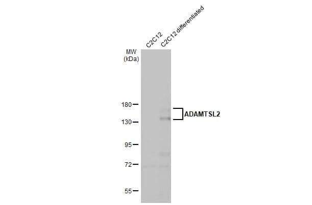 ADAMTSL2 Antibody (HL2616)