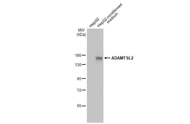 ADAMTSL2 Antibody (HL2616)