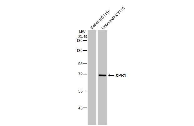XPR1 Antibody (HL2631)