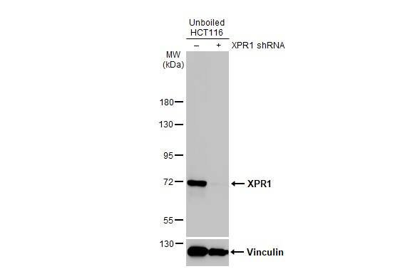 XPR1 Antibody (HL2631)