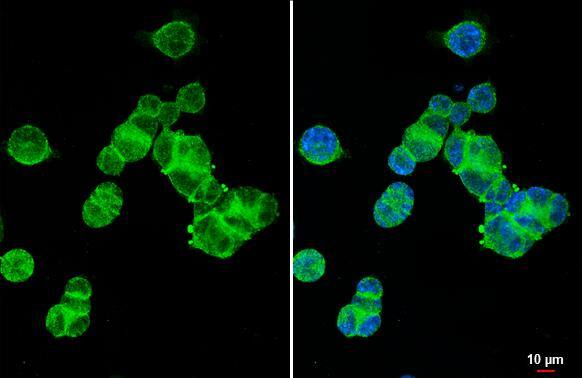 XPR1 Antibody (HL2632)