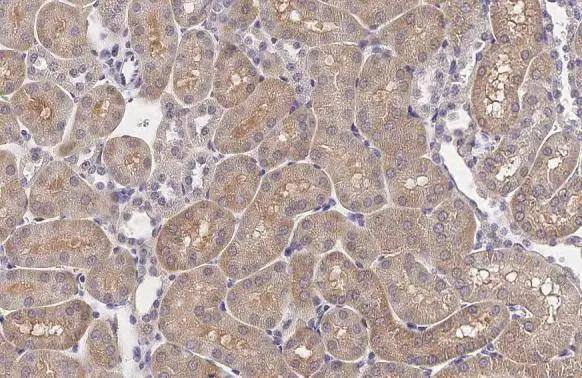 XPR1 Antibody (HL2632)