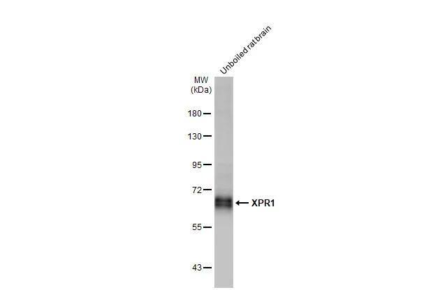 XPR1 Antibody (HL2632)