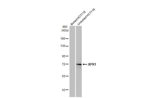 XPR1 Antibody (HL2632)