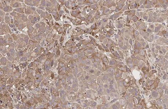 GnRHR Antibody (HL2638)
