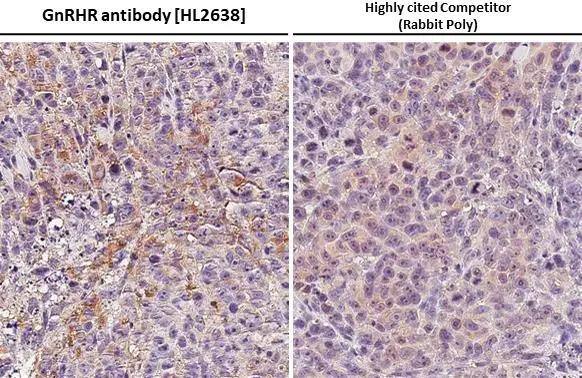 GnRHR Antibody (HL2638)