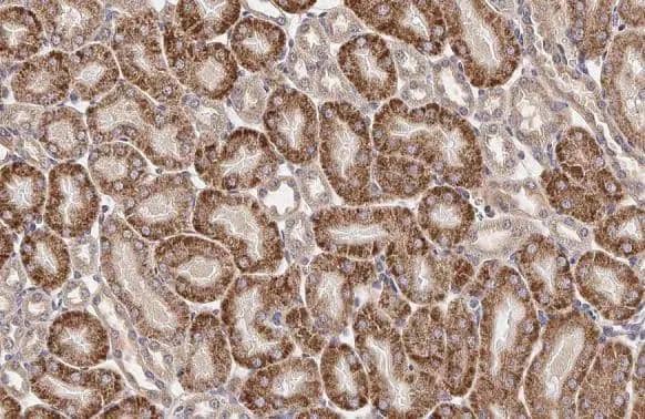 GnRHR Antibody (HL2638)