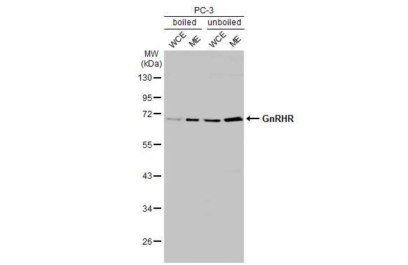 GnRHR Antibody (HL2638)