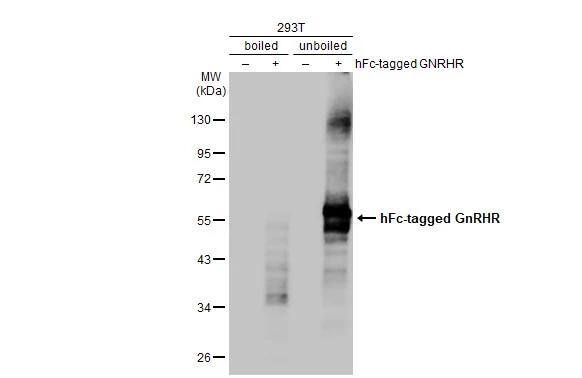GnRHR Antibody (HL2638)