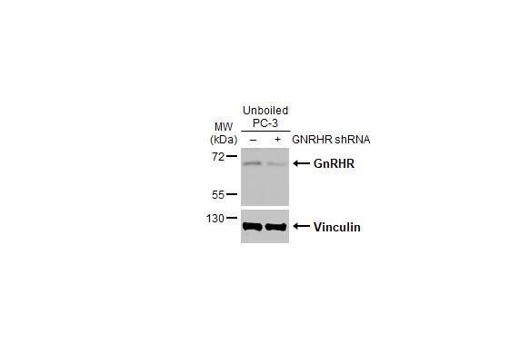 GnRHR Antibody (HL2638)