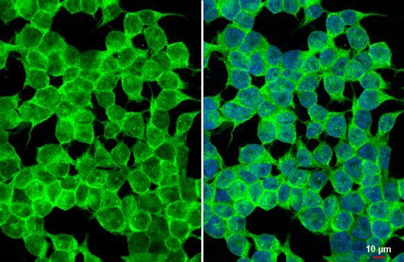 HAP40 Antibody (HL2641)