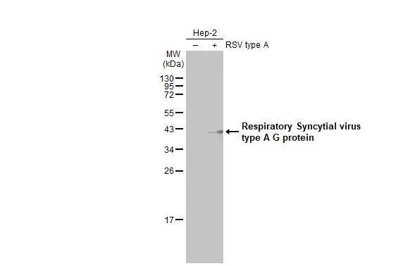 Respiratory Syncytial Virus Subgroup A G Glycoprotein Antibody (HL2643)