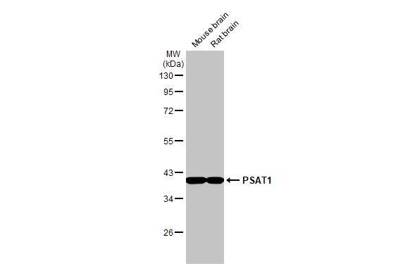 PSAT1 Antibody (HL2663)