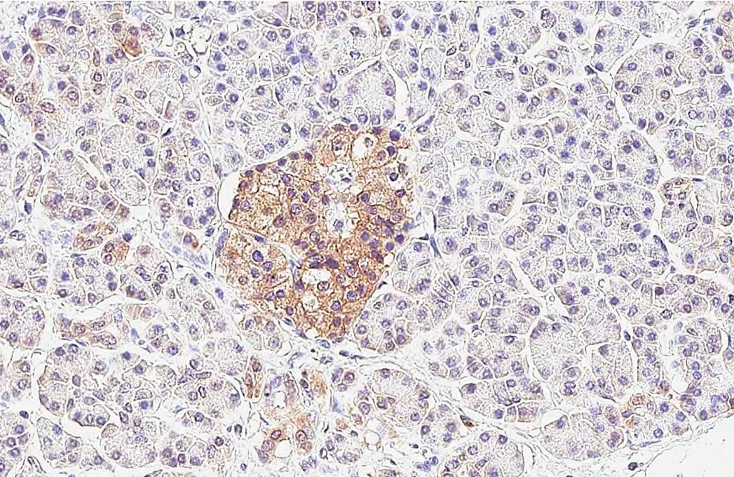 P2Y1/P2RY1 Antibody (HL2702)