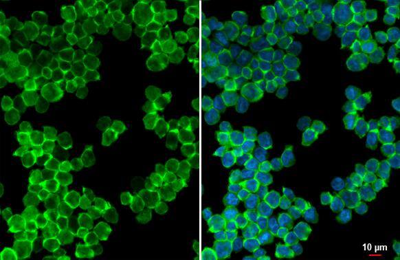 P2Y2 Antibody (HL2704)