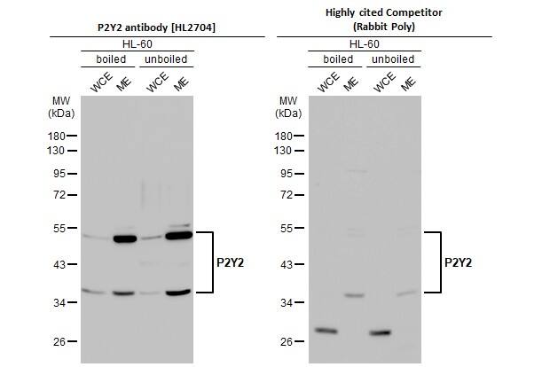 P2Y2 Antibody (HL2704)