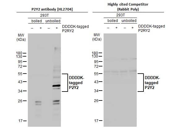 P2Y2 Antibody (HL2704)