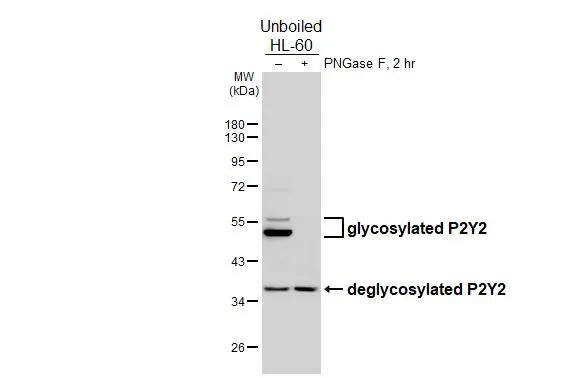P2Y2 Antibody (HL2704)