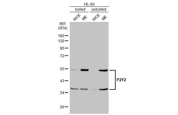 P2Y2 Antibody (HL2704)