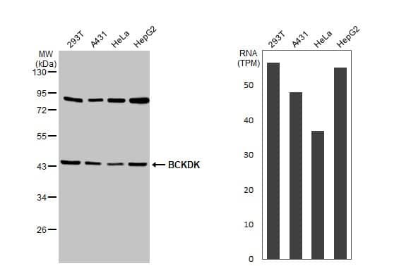 BCKDK Antibody (HL2710)