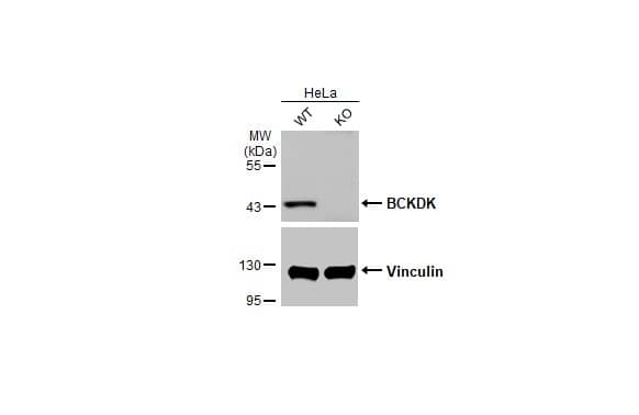 BCKDK Antibody (HL2710)