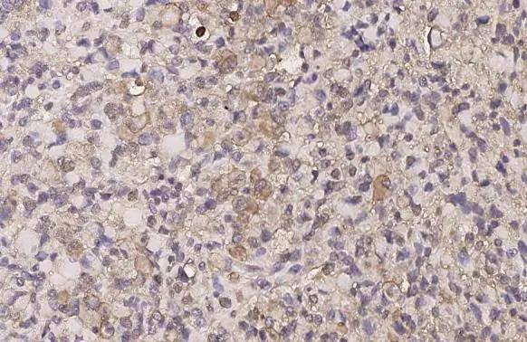 delta Opioid R/OPRD1 Antibody (HL2724)