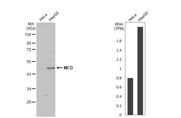 MLYCD Antibody (HL2738)