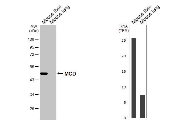 MLYCD Antibody (HL2738)
