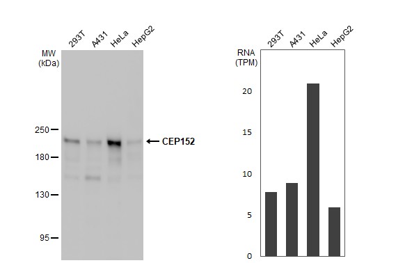 CEP152 Antibody (HL2763)