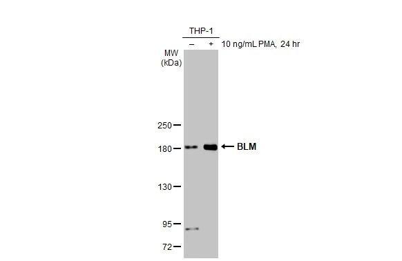 Blooms Syndrome Protein Blm Antibody (HL2771)