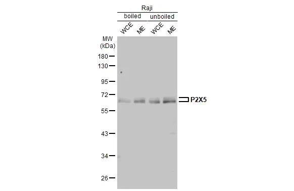 P2X5/P2RX5 Antibody (HL2773)