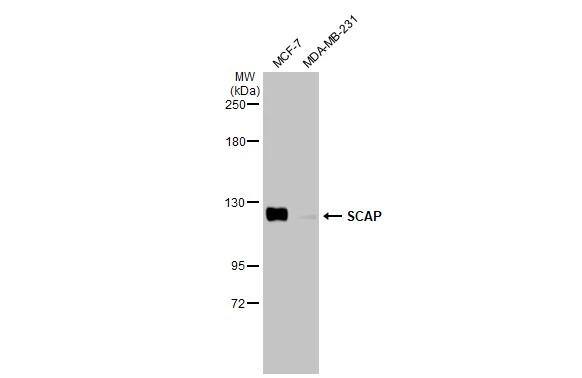 SCAP Antibody (HL2796)