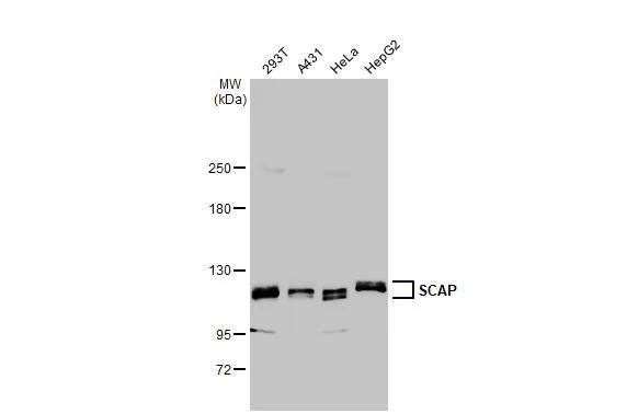 SCAP Antibody (HL2796)