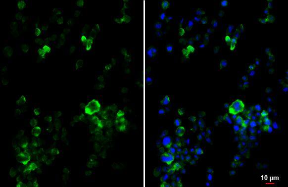 P2Y2 Antibody (HL2801)