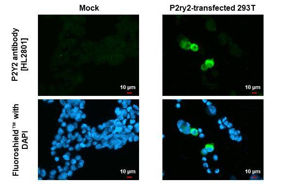 P2Y2 Antibody (HL2801)
